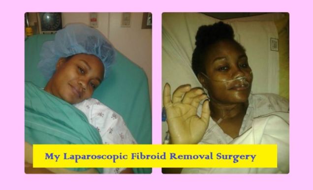 my-fibroid-surgery-in-india
